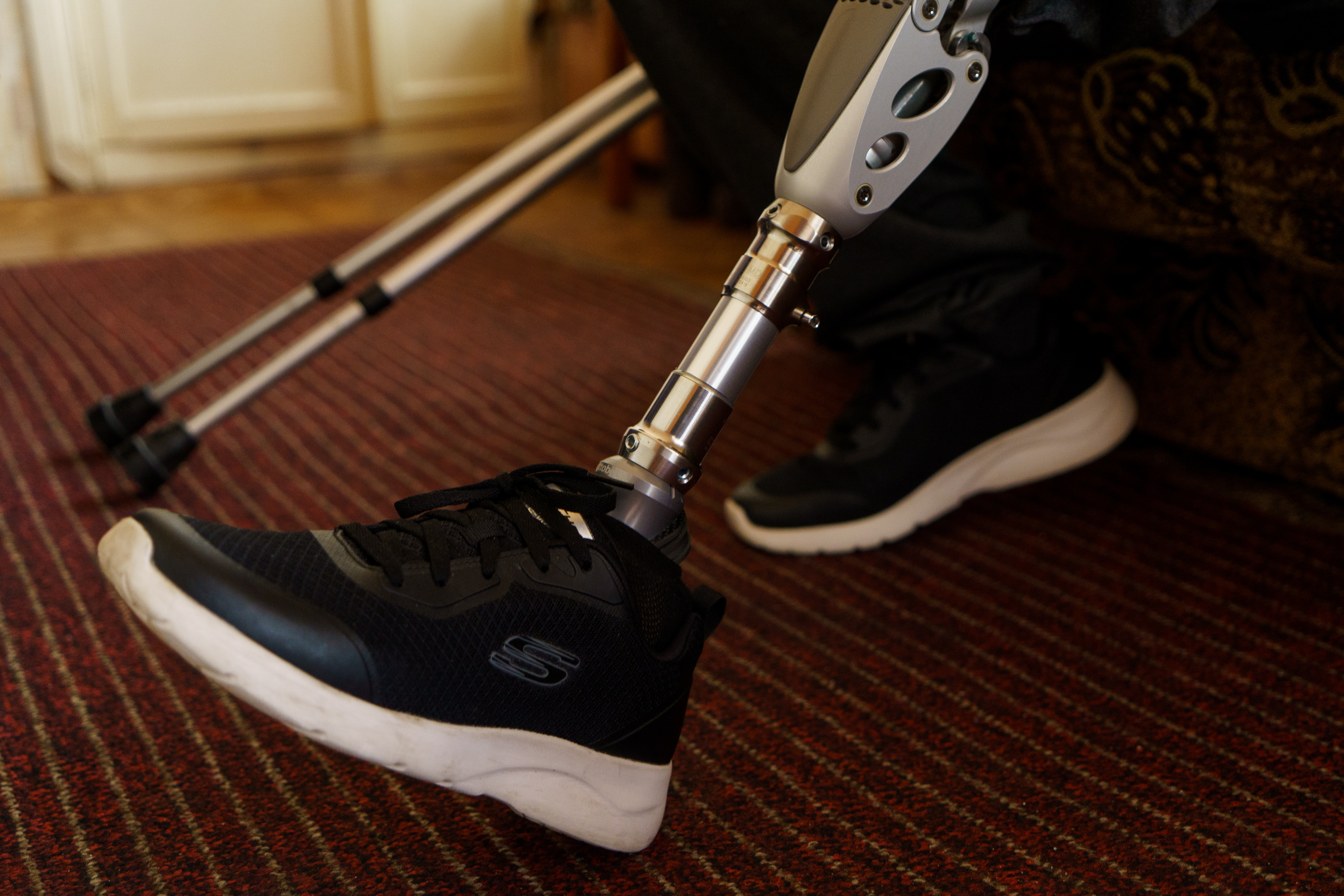 Ostap is learning how to walk and even drive a car with a prosthesis.©DRC Ukraine, Chernihiv Oblast, February 2023, Volodymyr Cheppel. 